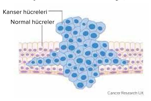 Normal hücreler arasında çoğalan kanser hücreleri